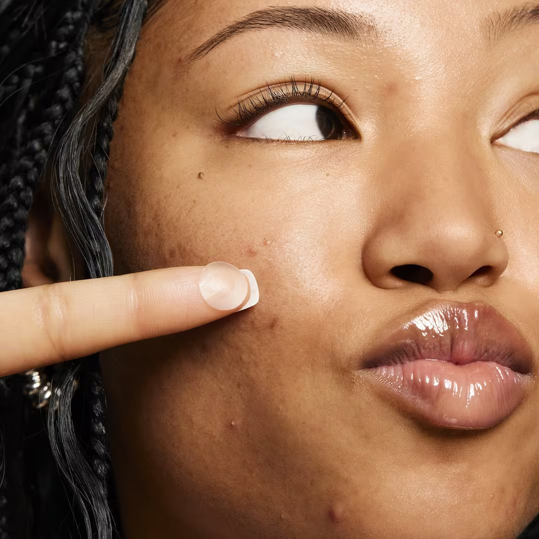 Blemish Breakthrough Stick It to Zits Pimple Patches