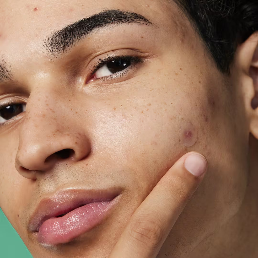 Blemish Breakthrough Stick It to Zits Pimple Patches