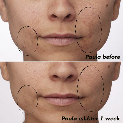 PLZ Clarify Facial Oil