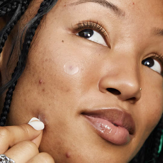 Blemish Breakthrough Stick It to Zits Pimple Patches